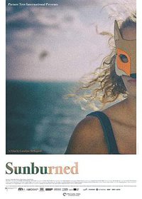 Sunburned